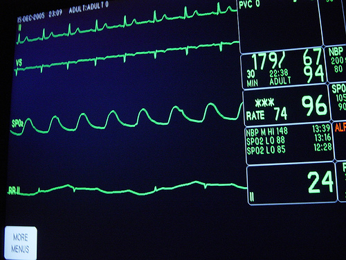 Heart Monitor Waves